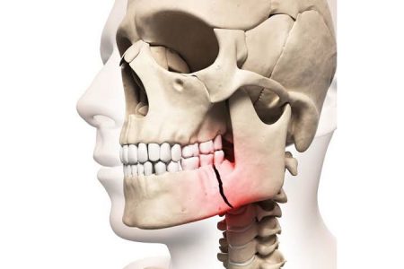 traumas-faciais-gleisse-wantowski