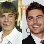 Zac Afron