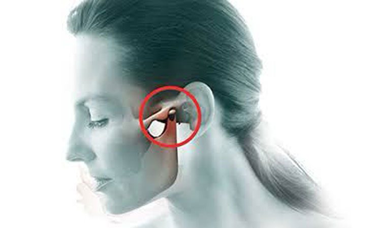 Cirurgia da ATM | Articulação Temporomandibular