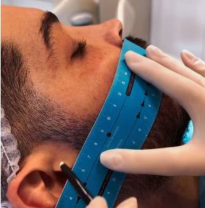 Individualização dos Tratamentos Cirúrgicos da Face: cada rosto, um plano único
